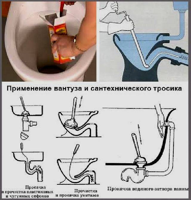 Как прочистить унитаз от засора в домашних условиях вантузом, сантехническим тросом, пластиковой бутылкой, бытовой химией
